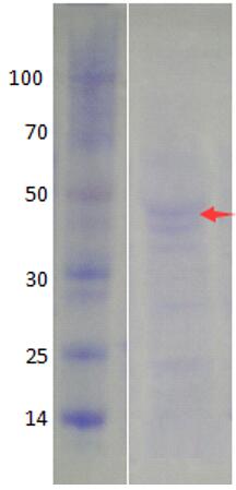 15% SDS-PAGE analysis profiles of purified KP1_1701-32-343 (CBB stained).